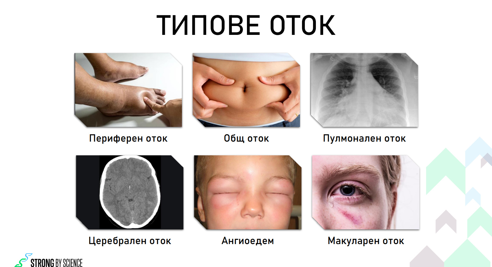 ВОДНА ЗАДРЪЖКА