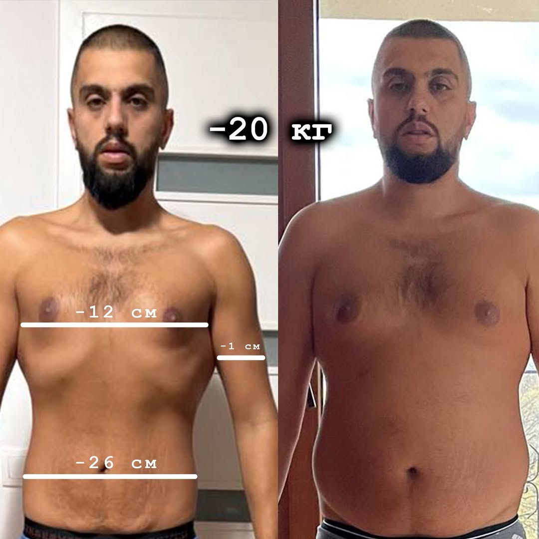 philip transformation